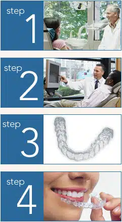 Invisalign Treatment Steps