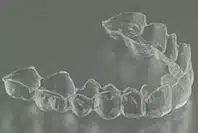 Essix Retainer
